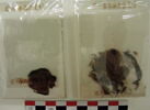 tunique  ; fragments, image 3/4